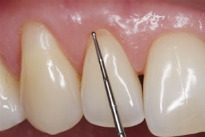 Choroby przyzębia a periodontologia
