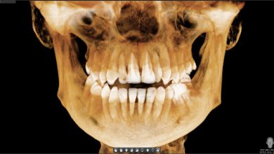 Tomografia 3D, czyli nowoczesna metoda diagnostyczna